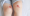 The image shows a close-up of two knees with signs of frostbite, a potential side effect of cryotherapy. The skin on both knees displays red, raw patches, indicative of frostbite damage caused by exposure to extreme cold temperatures. The affected areas appear tender and irritated, emphasizing the risks associated with improper cryotherapy procedures. The image serves as a reminder of the importance of carefully monitoring skin exposure during cryotherapy to prevent such injuries.