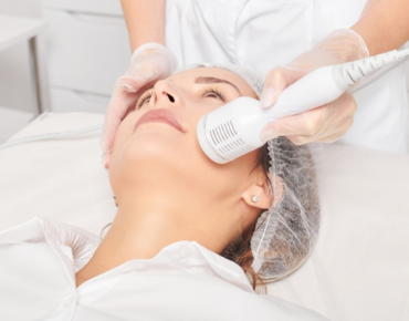 A person receiving a cryotherapy facial, with a handheld device applying cold treatment to the face for skin rejuvenation and tightening.