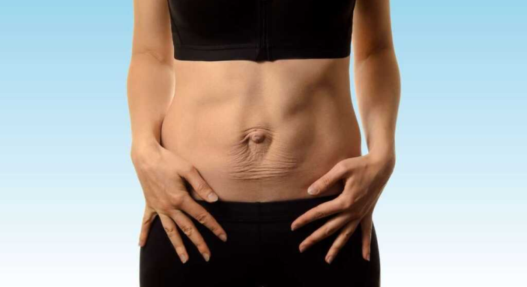 A person showing their abdominal area with visible signs of muscle weakness or misalignment, possibly related to navel displacement. The image highlights the impact of abdominal strain on core stability and posture.