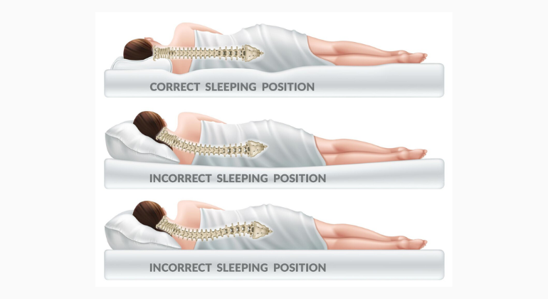 An illustration showing the correct and incorrect sleeping positions for spinal alignment. The top image demonstrates the proper posture with a straight spine, while the bottom two images depict incorrect positions that cause spinal misalignment.